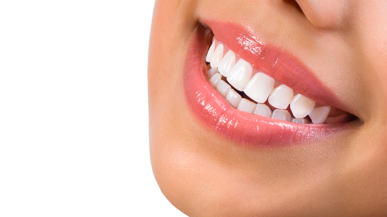 Smile With Veneers | Veneers Fayetteville AR | Dental Blog