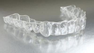 Clear Braces Fayetteville AR | Scott J Stephens Dental Blog